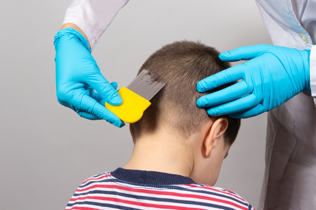 В Санкт-Петербурге с января по апрель текущего года зарегистрировали почти 1200 случаев педикулёза